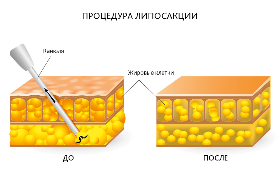 Untitled-1_900.jpg